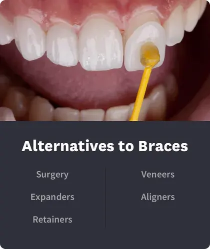 Alternatives to Braces