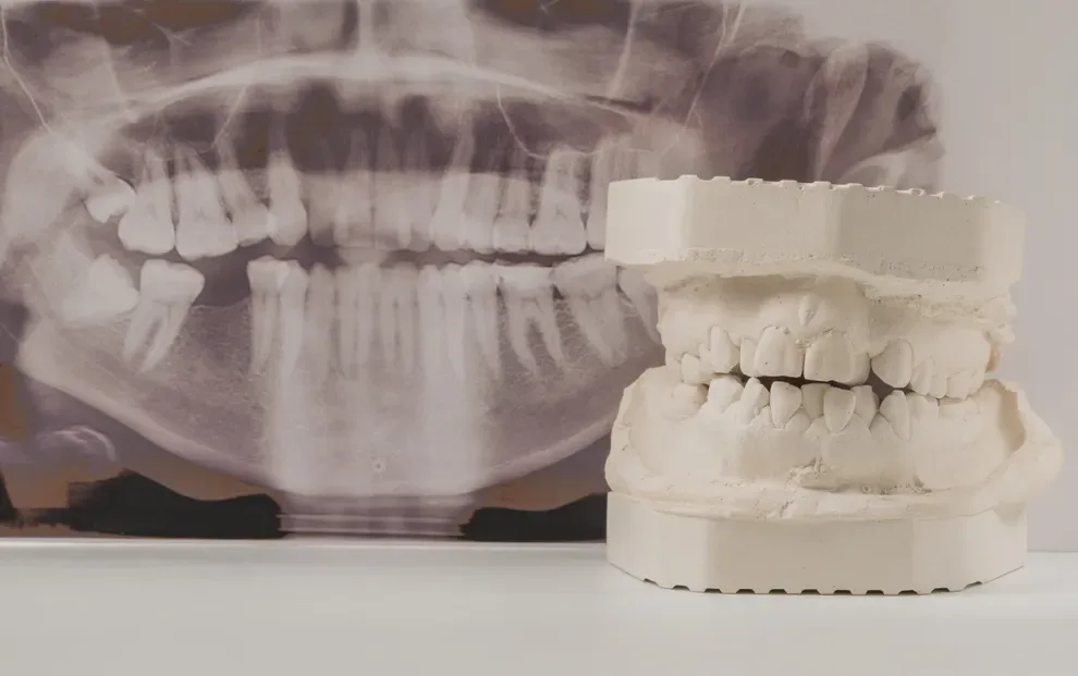 fix-crooked-misaligned-jaw