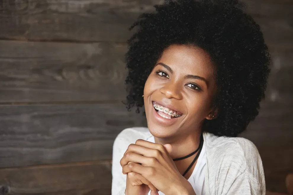 Woman with Top Braces Only