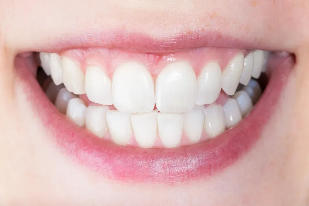 woman-with-bright-white-smile