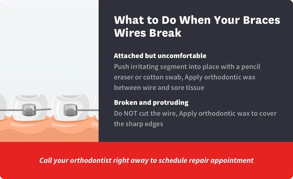 what to do when your braces wire breaks